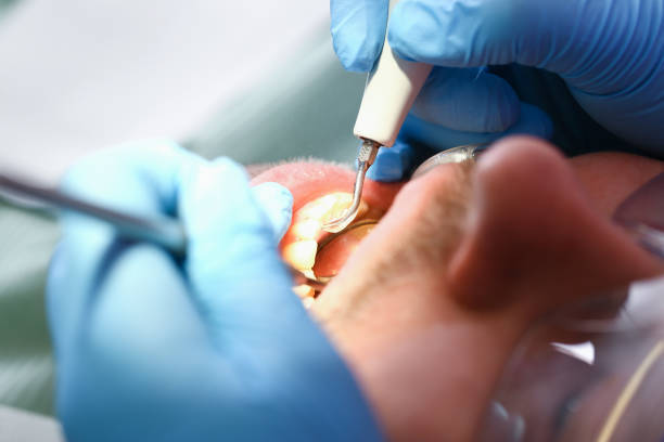 Best Emergency Dental Care for Abscessed Tooth in Hargill, TX