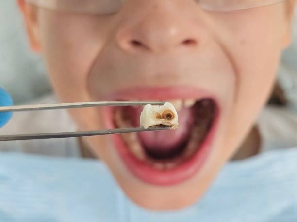 Best Urgent Dental Care for Toothache in Hargill, TX